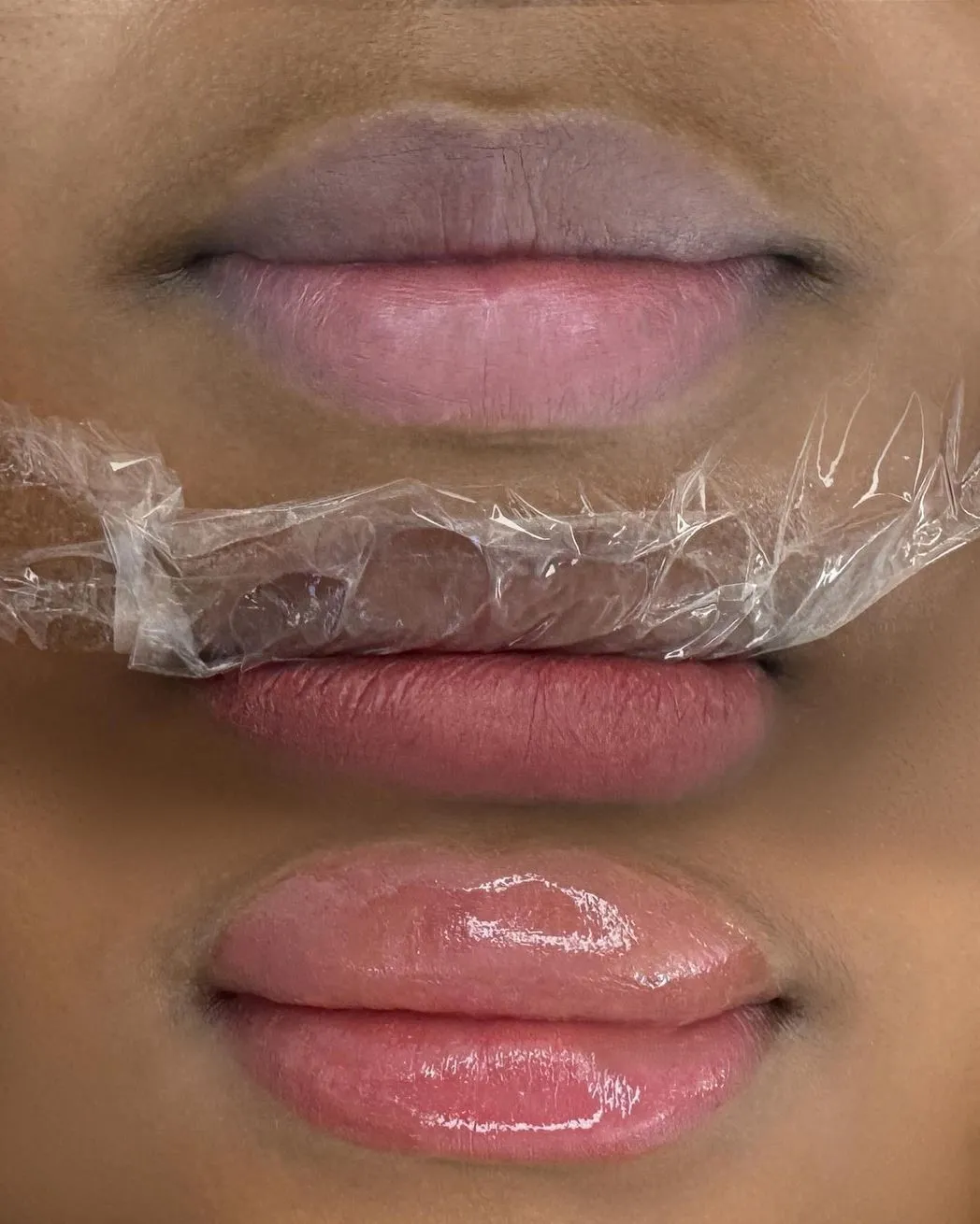 Follow Custom Aftercare Instructions